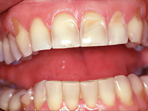 Pathologies dentaires