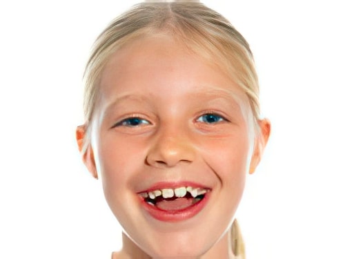 Caries dentaires Sugiez