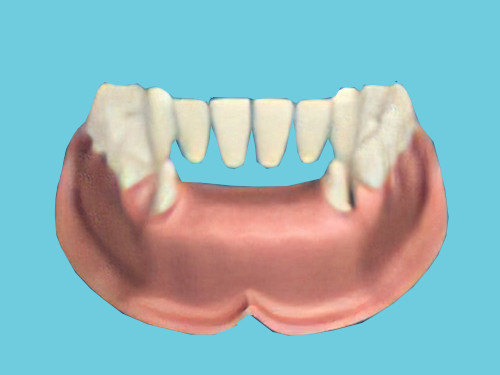 dentiste Gampelen Bridge dentaire