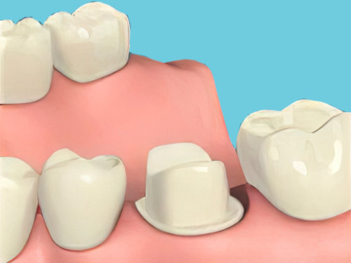 taille dentaire Sugiez