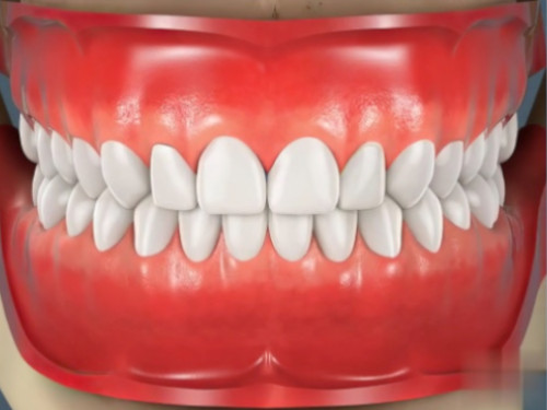 Dentiste Vallamand_1 Facettes_Dentaires_