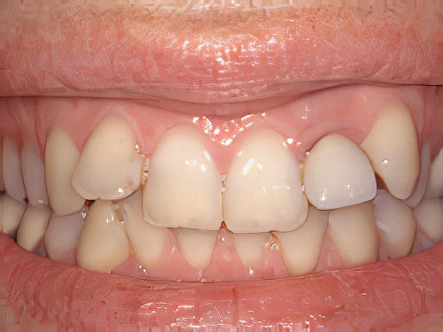 Dentiste Vallamand Harmonie_Sourire_01