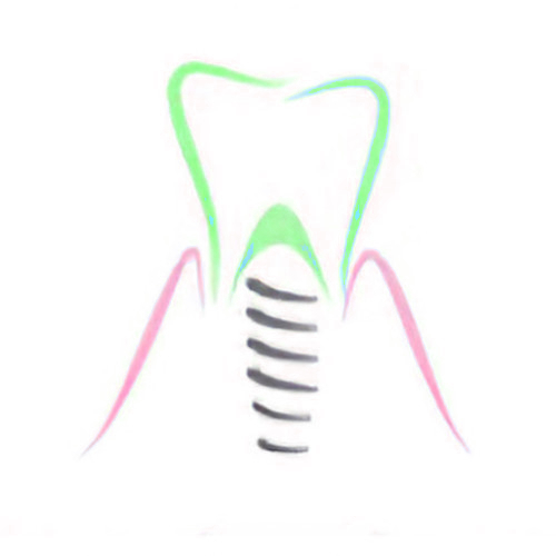 dentiste Cudrefin implant dentaire