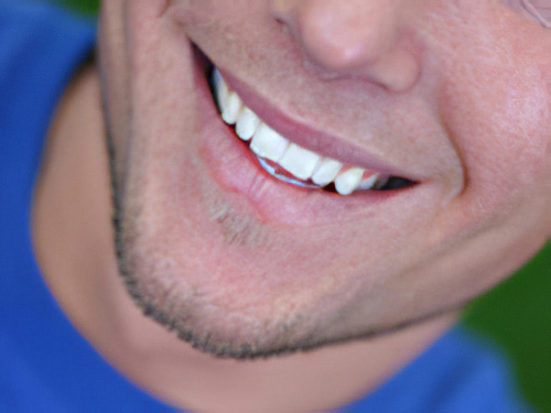 Dentiste Vallamand esthétique du sourire